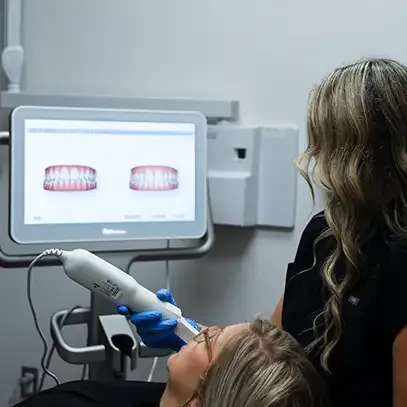 CEREC wand