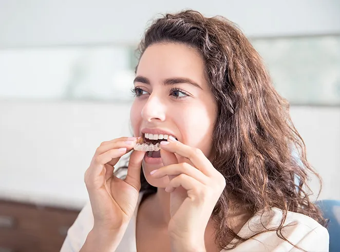 Woman inserting Invisalign clear aligner